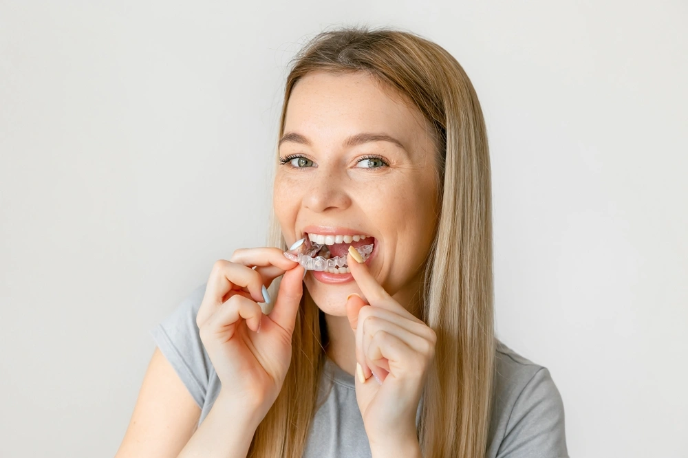 Woman placing a clear aligner on her teeth, illustrating orthodontic treatment